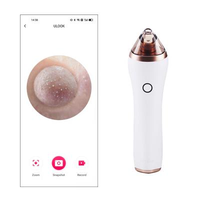 China New acne treatment wifi 20x pore suction remover rechargeable visual deep clean acne remove beauty blackhead remover vacuum facial camera for sale