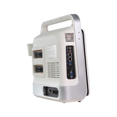 China 3D Doppler de Ultrasone klankscanner Windows 7 11KG van Ce Te koop