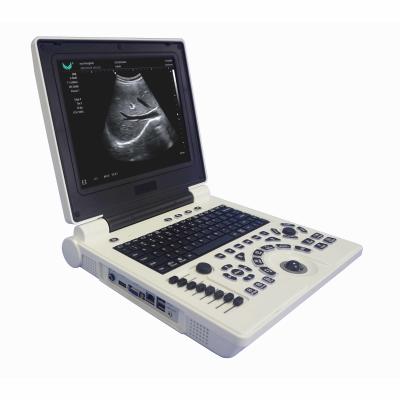 China USG OB GYN Portable USG Machine IMT Automatic Measurement for sale