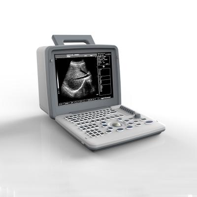 China Full Digital OB GYN USG Scan Machine 0 To 120dB 12in Led Display for sale