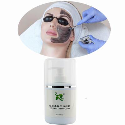 China Soft Anti-Puffiness Laser Carbon Cream Gel Carbon Laser ND Yag Laser Carbon Gel Cream for sale