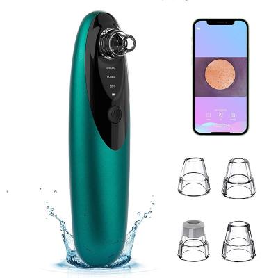 China Black Head Rechargeable Blackhead Removal Tool Facial Clean Electric Vacuum Pore Remover With Camera for sale