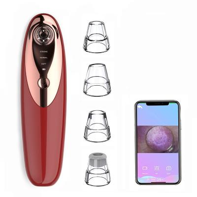 China Amazon Factory Price Blackhead Remover Black Head Blackhead Remover Pore Head Hot Nose Remover Vacuum Blackhead Remover Vacuum Black Head Cleaning Remover for sale