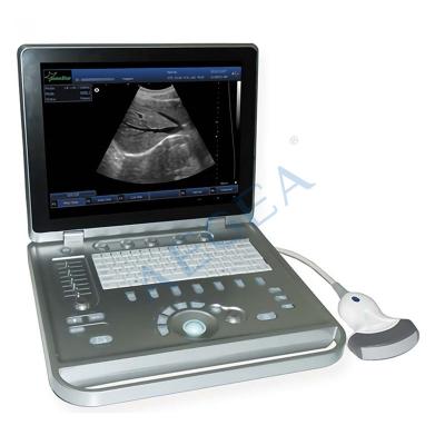 China Notebook AG-BU009 Available Full-digital Type Ultrasound Device Medical Scanner Can Custom Based on Customers Request 1% CE Free 18 Months for sale