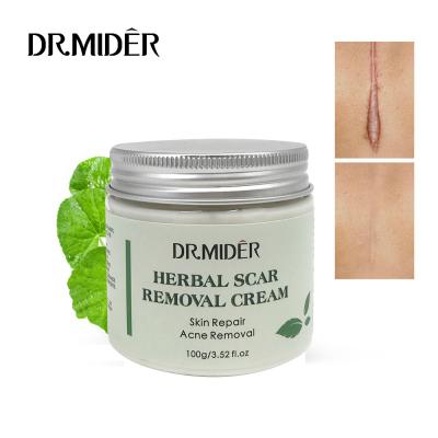 China Wholesale Nourishing Night Oil Control Skin Repair Acne Scar Removal Cream Spot Treatment Tea Tree Oil Acne Scar Removal Cream for sale