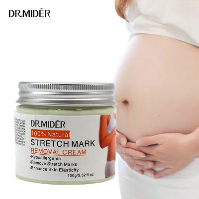 China Pregnant Skin Repair Anti Skin Revitalizer Dr.Mider Private Label Extract Organic Herbal Scar Increase Skin Elasticity Prevent Stretch Mark Cream for sale