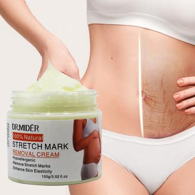 China Organic Moisturizer Remove Stretch Marks Cream Anti Wrinkle Maternity Repair Anti Aging Skin Remove Pregnancy Marks Treatment Body Skin Care for sale