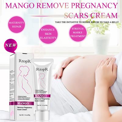 China White Skin Revitalizer OEM Tcm Stretch Mark Scar And Acne Removal Gel Pregnancy Spot Belly Cream For Skin Tightening for sale