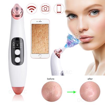 China Other Wifi Camera Vacuum Suction Led Visual Deep Facial Skin Care Tool Visible Button Display Pore Vacuum Blackhead Remover for sale