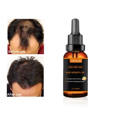 China Hair Wholesale Best Private Label Hair Care Natural Organic Hair Growth Oil for sale