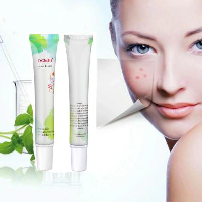 China Acne Anti Aging Treatment Best Quality O'chelli Cream Pimple Brands Removal Cream for sale