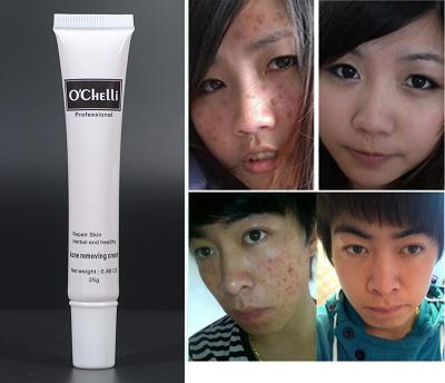 China The best anti aging quality a day can see to perform acne pimple correction for sale