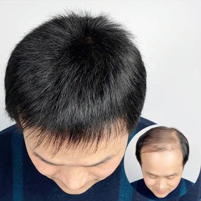 China 100% Real Hair Bq Mens Hair Replacement Wig 100% Hair Correction Men Toupee Hair for sale