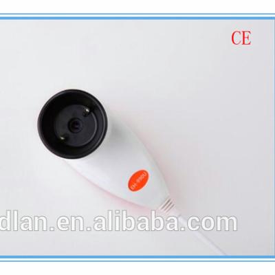 China High Definition NEW MP 5.0 USB Digital Eye Iriscope With High Quality for sale