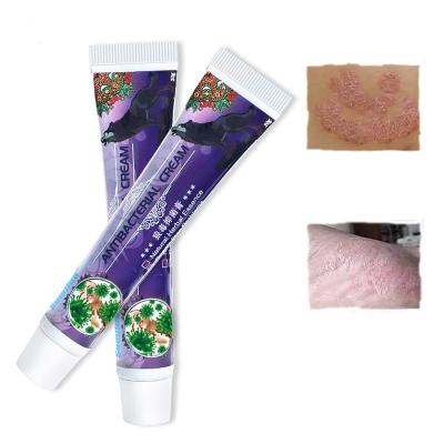 China Psoriasis Antibacterial Ointment Dermatitis Eczema Wolf Venom Anti-itch Cream Body Skin Care Chinese Herbal Medical Oil for sale