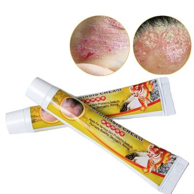 China Tiger Balm Eczema Cream Skin Care Psoriasis Antibacterial Dermatitis Pruritus Eczematoid Herbal Anti-itching Medical Ointment for sale