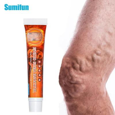 China Varicose Veins Ointmnet Vasculitis Phlebitis Spider Cream Varicosity Angiitis Removal Herbal Medical Plaster for sale