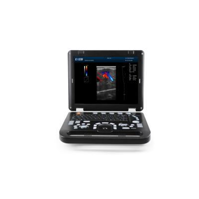 China Acrylic Color Doppler Ultrasound Scanner With High Pulse Repetition Frequency for sale