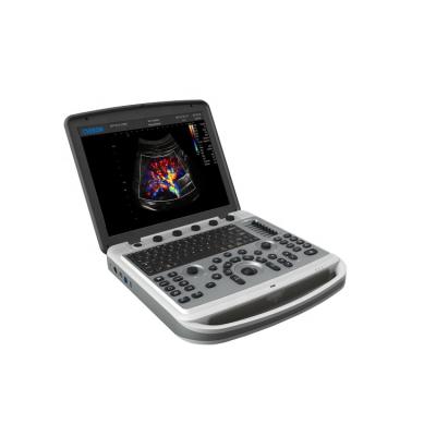 China Plastic Chison Ultrasound Machine With 15 Inch High Resolution Led Monitor for sale