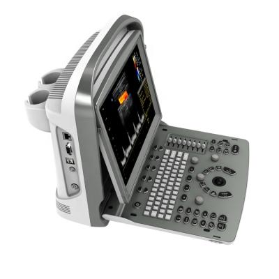 China Plastic Portable Full Screen Display Mode Chison Ultrasound Machine for sale