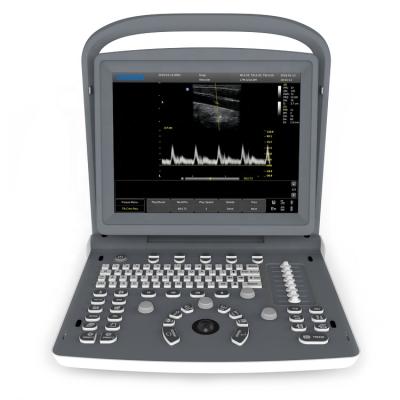 China Full Screen Plastic Portable Mode Chison Ultrasound Machine With 12 Inch Led Monitor for sale