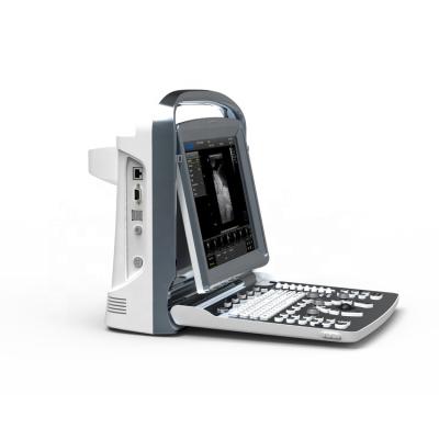 China Factory Sale Plastic 12 Inch Led Monitor Chison Medical Ultrasound Machine for sale