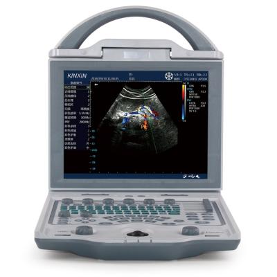 China Wholesale Acrylic Digital Full Color Doppler Veterinary Portable Ultrasound Scanner for sale