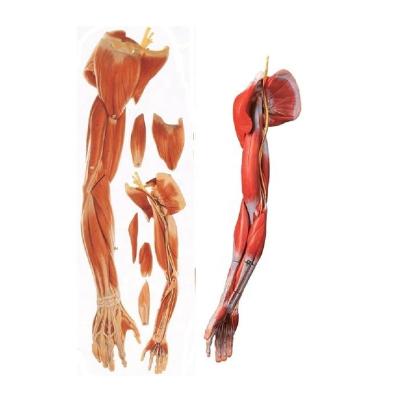 China Teaching the Upper Limb Dissection Model for sale