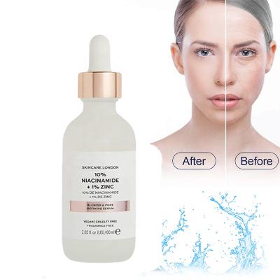 China Professional Skin Revitalizer OEM ODM b3 Serum Face Care Whitening Anti-Aging Anti-inflammatory Nicotinamide Face Serum for sale