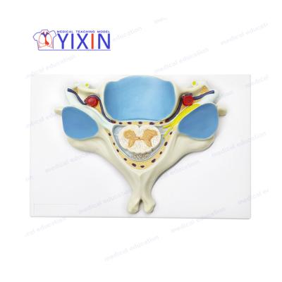 China Durable Enlarged 5th Cervical Vertebra Spine Model with Skeletal Spinal Cord Human Anatomy Part for Medical Science Education for sale