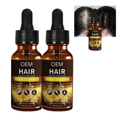 China Rosemary Oil Wild Black Women Super Natural Organic Men's Oil Serum Growth Loss Prevention OEM China Hair Wild Hair for sale