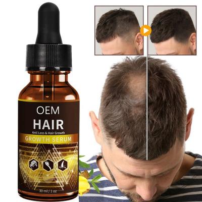 China NEW Color-Protecting TIKTOK 2022 Private Label Hair Growth Serum Wholesale Natural Organic Herbal Hair Loss Oil Anti Hair Growth Boosting Oil for sale