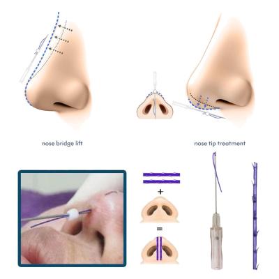 China Safe and reliable L type factory wholesale Pdo tooth nose blunt for nose lifting for sale