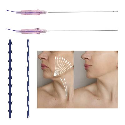 China NEW safe and reliable strong hook wire face body lift skin tighten 19G 100mm W needle facials lifting pdo mount tooth wire for sale