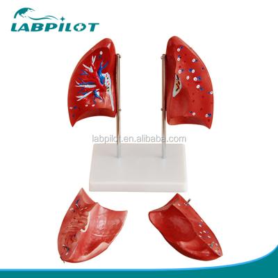 China Anatomical Structures Detailed Lung Anatomy Models 4 Parts, Human Lung Model for sale