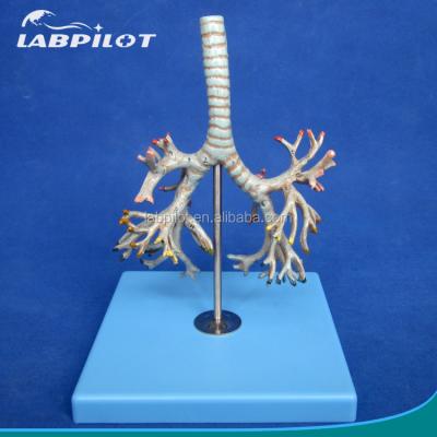 China Detailed Medical Human Anatomy Structures Bronchia Model , Trachea Model Bronchi for sale