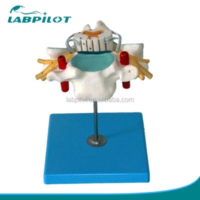 China Detailed anatomical model model of Anatomical Cervical Vertebra with spinal cord and nerves for sale