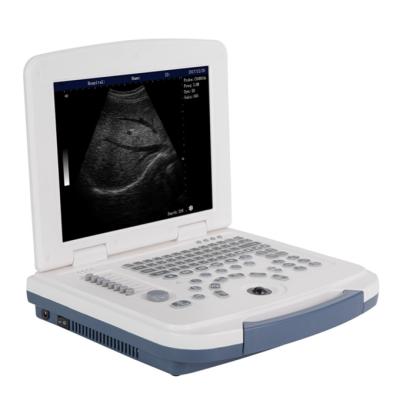 China Good Price Cheapest RC-BW580 Abdomen Ultrasound Scanner Veterinary Portable Ultrasound Machine for sale