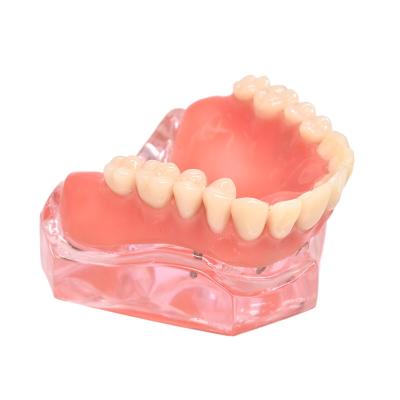 China Dental Equipment Dental Lab Denture False Teeth Regional Higher Quality Acrylic for sale