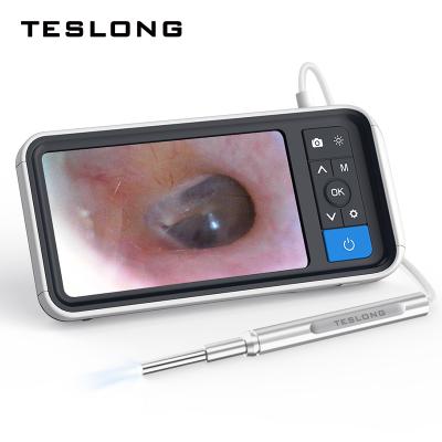 China Metal Diameter 3.9mm USB Digital Endoscope Otoscope for Ear Canal Inspection for sale