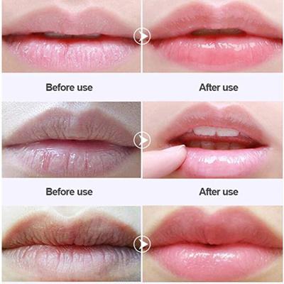 China Custom Vegan Anti Wrinkle Konjac Lip Patch Cruelty Free for sale