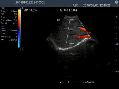 China Portable Ultrasound Scanner Color Doppler Machine With 15 Inch LCD Monitor for sale