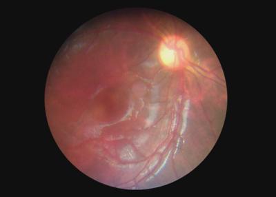 중국 눈 광학 장비 인후 사진기 2백만개의 화소를 가진 영상 이경 Dermatoscope 디지털 방식으로 내시경 판매용