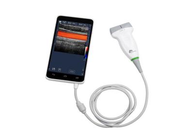 China Andriod-Farb-Doppler-Ultraschall-Scanner, Hand-Doppler-Maschinen-nur Gewicht 550g zu verkaufen