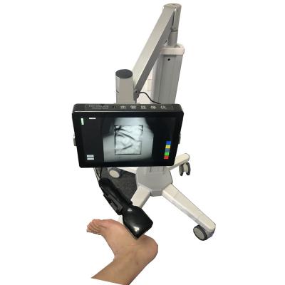 China Medical Vein Finder Safe Light Source Infrared Vein Finder No Laser With No Radiation for sale