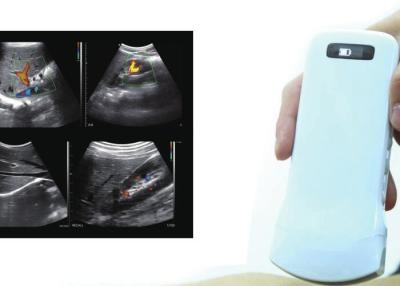 China Hand Held Ultrasound Wireless 10mhz Doppler Probe for sale