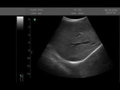 BIO-3000P scans liver