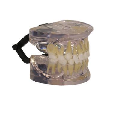 China Made of PVC Transparent Adult Teeth Dental Nursing Model ADA-L1007 for sale