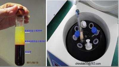 China PRP kit Medical Centrifuge 4,000rpm 10ml syringe tube Brushles Motor for sale