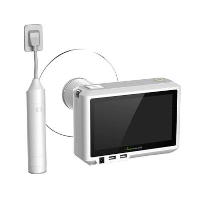 China Portable Mobile X Ray Radiography System Digital Acrylic Portable X-Ray Series X-Ray Machine Radiography Machine for sale